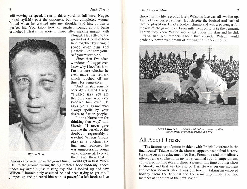 A page from 'My Football Life' picturing Trizzie Lawrence injured on the field and Wilson Onions with bruising to his face.